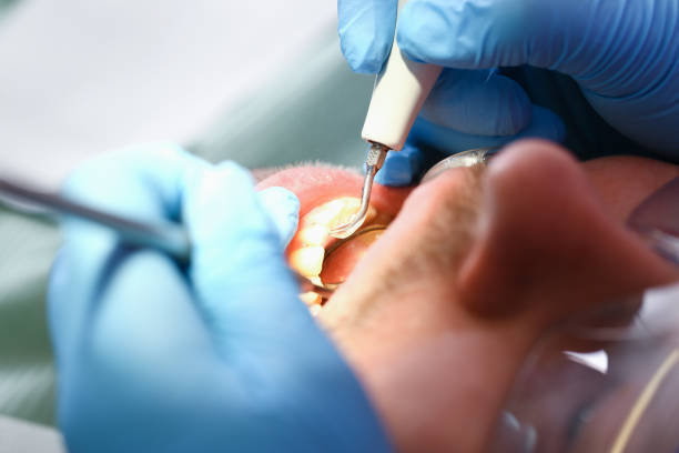 Best Emergency Gum Treatment in Crown Pot, IN