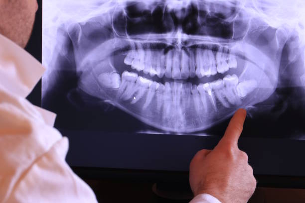 Best Emergency TMJ Treatment in Crown Pot, IN