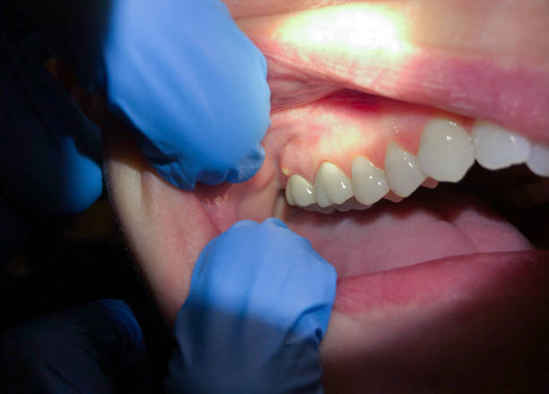  Crown Pot, IN Emergency Dentist Pros
